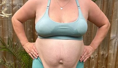Abbi Smith gained five stone and an unsightly bulge after her pregnancy caused an umbilical hernia and diastasis recti, a condition in which the stomach muscles separate