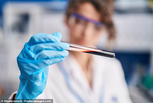 A simple blood test can tell which patients will rapidly develop severe Alzheimer’s, a study reveals