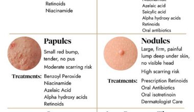 The correct way to treat a troublesome spot depends on the type you have, the doctor warned