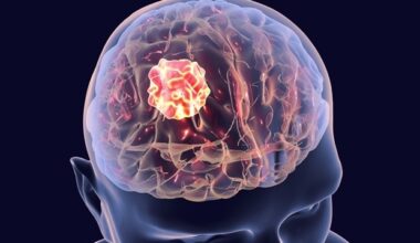 Mapping genetic activity offers new clues for personalized cancer treatment