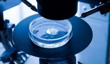 IVF treatment