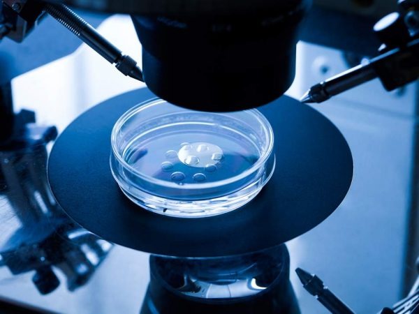 IVF treatment