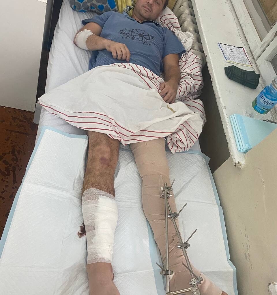 Ukrainian Swimmer Igor Chervynskiy, 3x World Championship Medalist, Injured in War with Russia