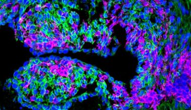 Genetic Code Enables Zebrafish to Mend Damaged Organs