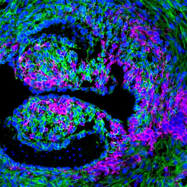 Genetic Code Enables Zebrafish to Mend Damaged Organs
