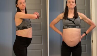 Fitness Trainer Didn’t Go to the Doctor for 7 Years and Had a Huge Cyst (Exclusive)