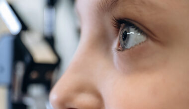 Close-up profile of a child’s face, focusing on their right eye during an eye examination.
