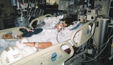 ‘I was the first person to survive rabies without a vaccination’