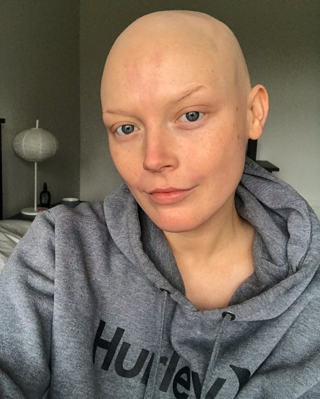 I had no idea my itchy skin meant I had a deadly disease https://www.instagram.com/georgieeswallow/