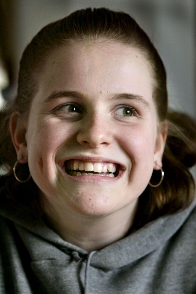 2F15R5E Jeanna Giese is the world's first survivor of the rabies virus without inoculation. Giese nearly died when she developed a full-blown case of rabies after being bitten by a bat at church in Fond du Lac, Wisconsin. (Photo by Rick Wood/Milwaukee Journal Sentinel/MCT/Sipa USA)