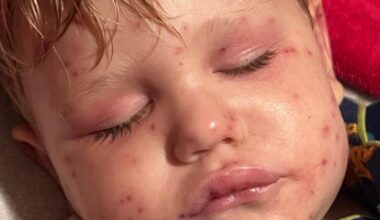 Boy, 2, fighting for his life after being stung by wasps 150 times | News US