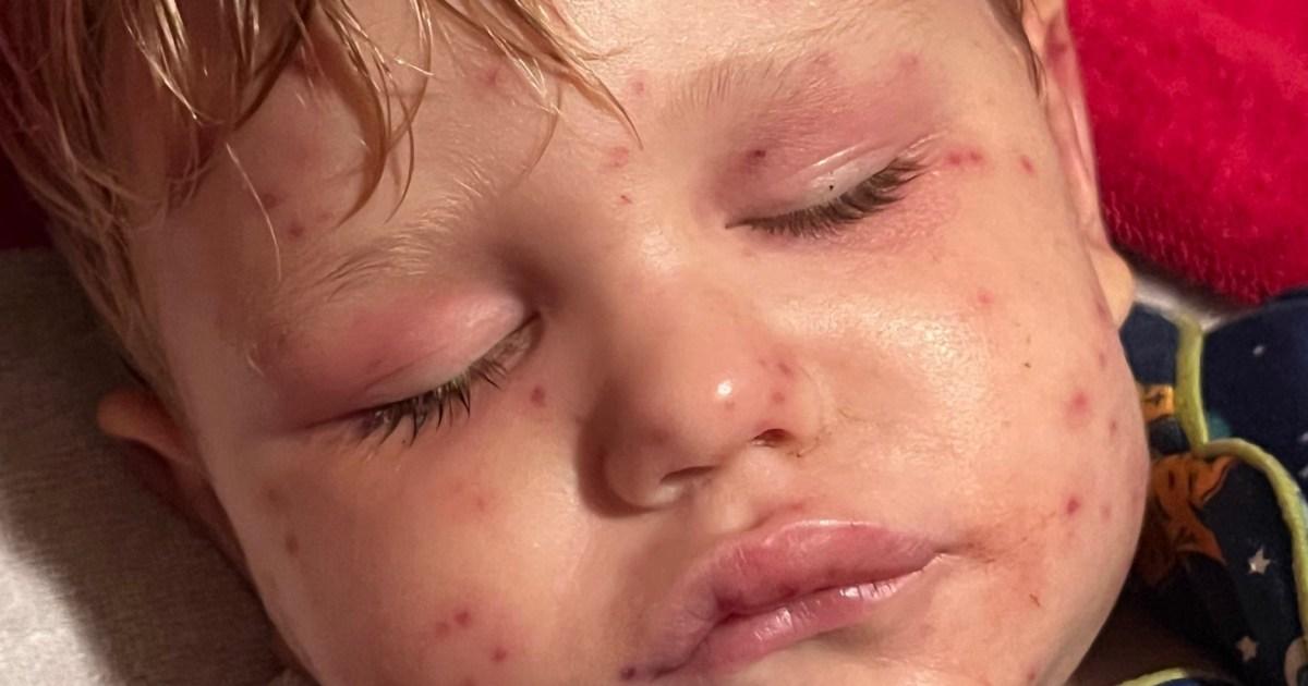 Boy, 2, fighting for his life after being stung by wasps 150 times | News US