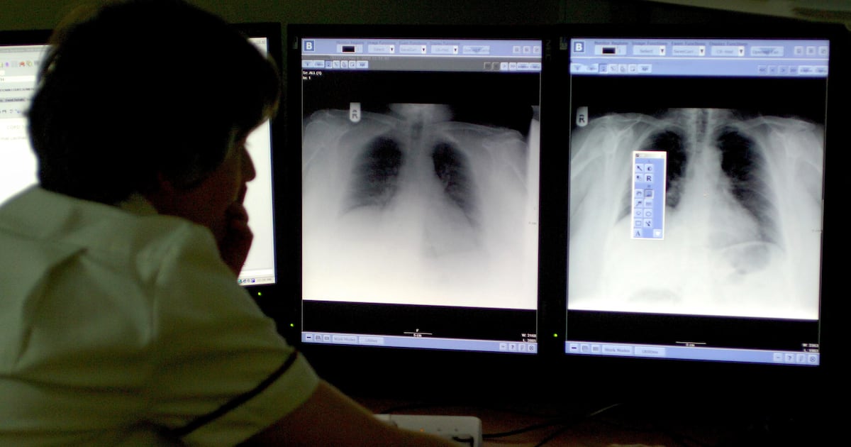 Northern Ireland’s cancer patients facing ‘a ticking time bomb’ over doctor shortages – The Irish News