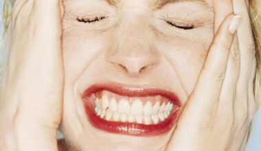 Do you have 'Cortisol Face?'