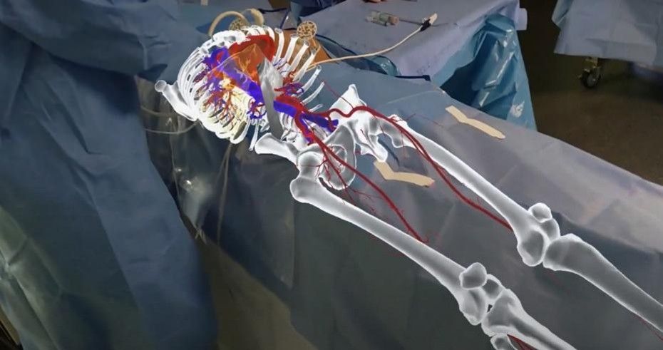 AR/VR's Potential in Health Care