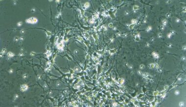 Autism Stem Cell Library Reveals Key Genetic Insights