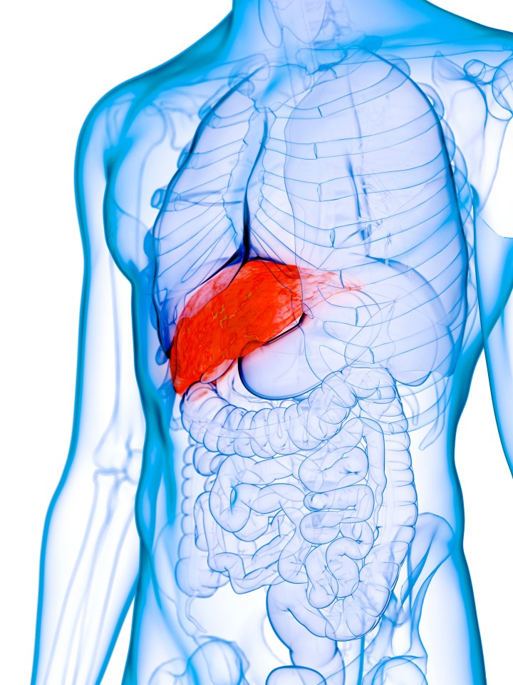 Illustration of a diseased liver.
