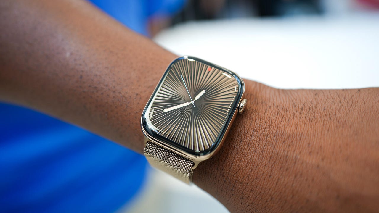 Apple Watch Series 10 in Jet Black.