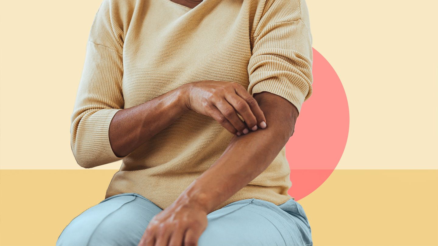 Abruptly Stopping Certain Allergy Drugs Can in Rare Cases Lead to Severe Itching, FDA Says