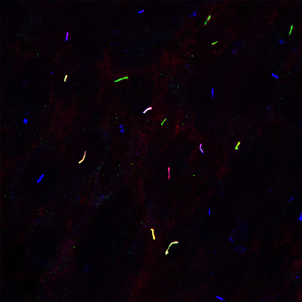 UTSW scientists link another gene to obesity : Newsroom