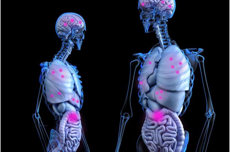 Genetic changes control metastasis formation