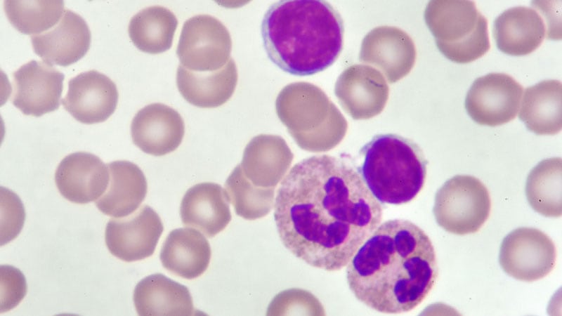 Genetics or Microenvironment: What Drives CLL Progression?