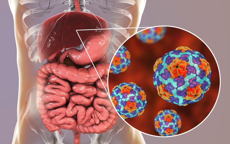 Illustration of Hepatitis A viruses and the human liver and digestive system.