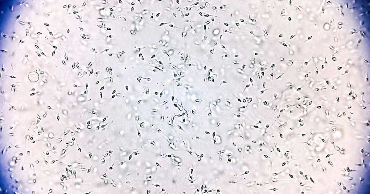 Sperm donor with rare genetic mutation fathered 67 children. Ten now have cancer