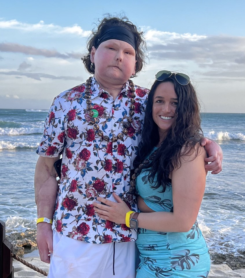 A man and woman stand on a beach; the man received a face and double hand transplant.