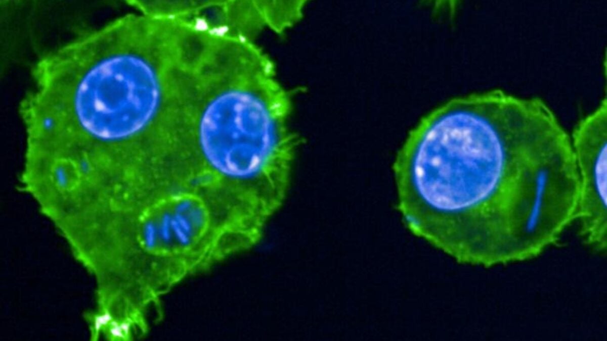 This Genetic 'Trick' Helped the Black Death Linger for Centuries