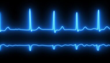 Study links different genetic pathways causing irregular heartbeats to different risks of stroke — Nuffield Department of Population Health