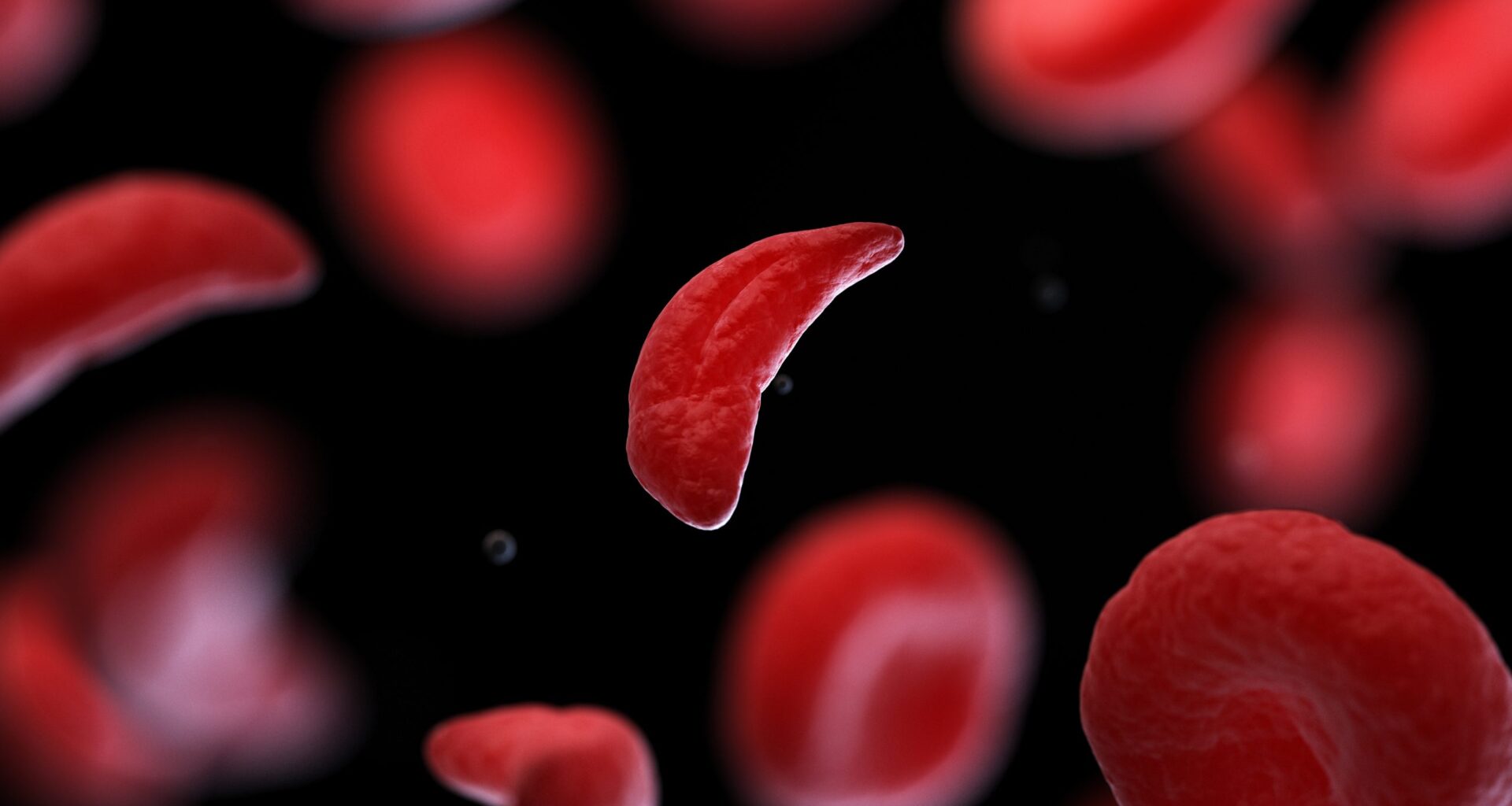 ‘Delete-to-recruit’: new gene-editing method targets sickle cell