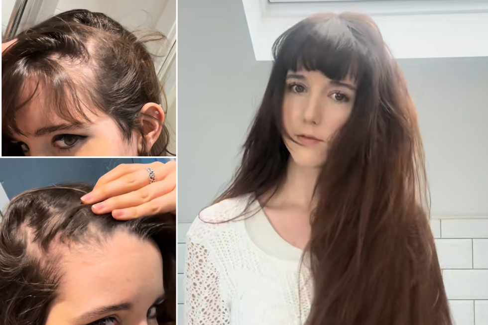 @sofiahairhealth - growth transformation