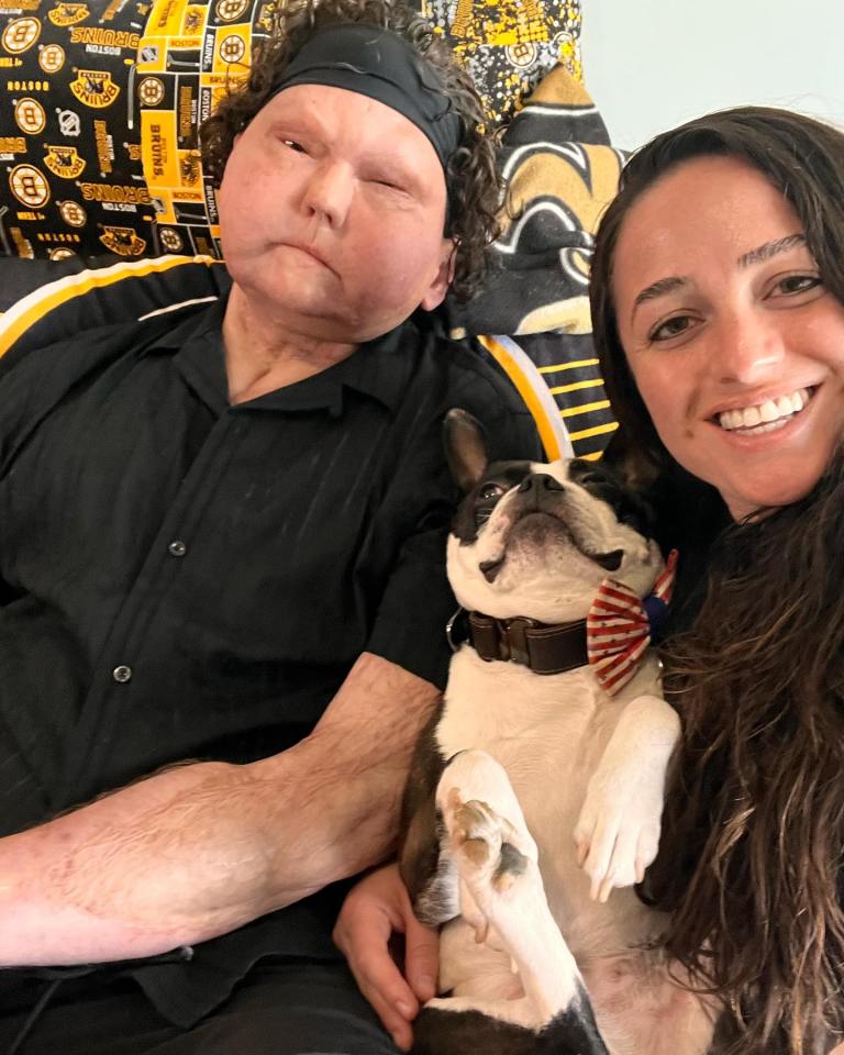 A man and woman with their dog; the man received a face and double hand transplant.