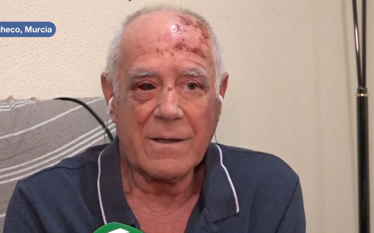 Elderly man with facial injuries from assault.