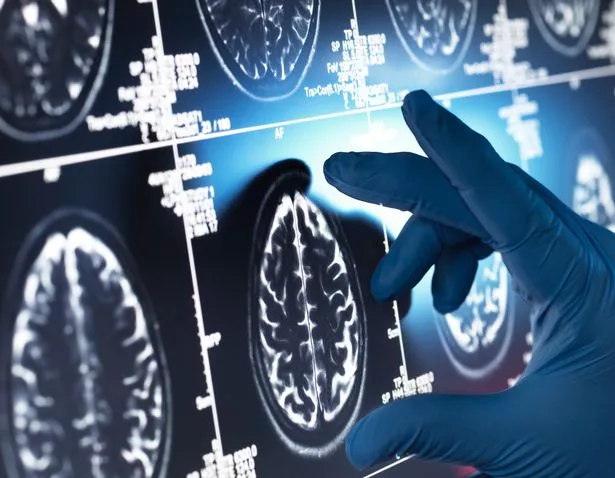 Brain scan and doctor examining data