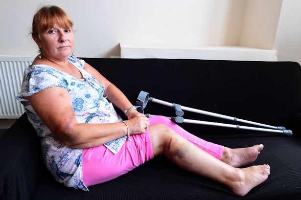 Carol Falla suffered injuries after being hit by an E-bike in the city centre