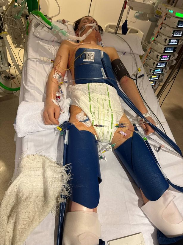 Jacob in hospital after the collision