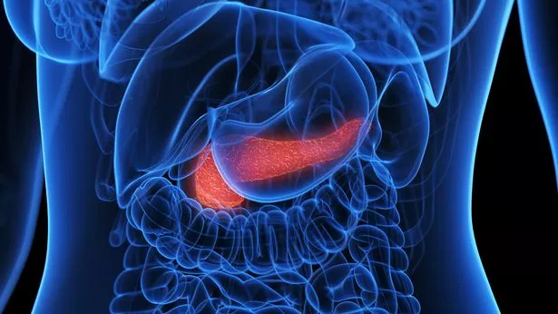 Inflamed pancreas, illustration