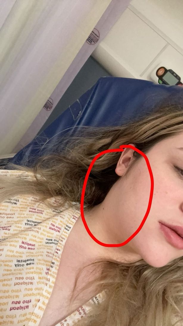 A lump developed on Ruby's neck in 2023