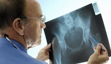 More than 100 leading NHS doctors have warned Health Secretary Wes Streeting that failing to honour his pre-Election commitment to urgently rollout screening clinics for osteoporosis risks causing thousands of preventable deaths (stock image)