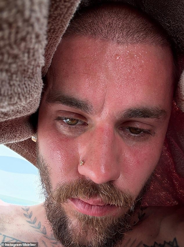 On Sunday morning, Bieber shared a sweaty selfie while on a 'detox'