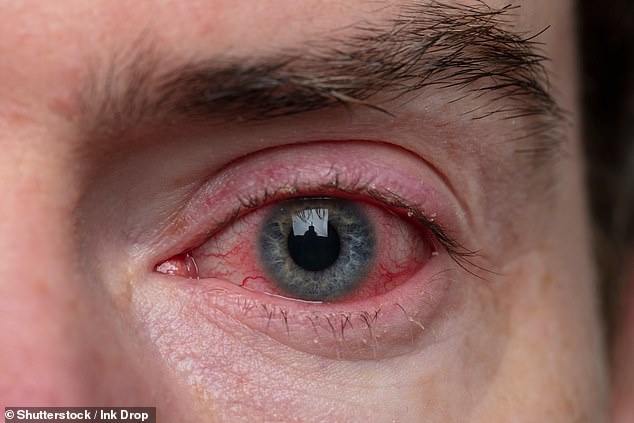 The eye drops work by suppressing the immune system and dampening the allergic reaction seasonal allergy sufferers experience - but this specific batch could potentially cause inflammation and serious infection resulting in vision loss