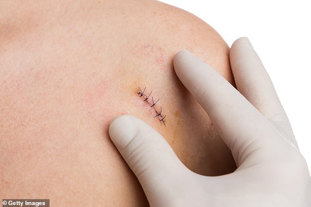 Biopsies, which involve removing small samples of tissue from the affected body part, can be painful, invasive and a source of considerable stress