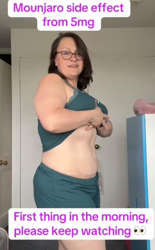Kayleigh shared her symptoms with her 6,000 TikTok followers, saying that she suffers painful bloating every time she takes the medication
