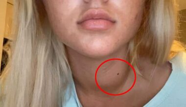 In January 2022, Courtney's friends noticed a lump that was growing on her neck, pushing her to seek another opinion from doctors