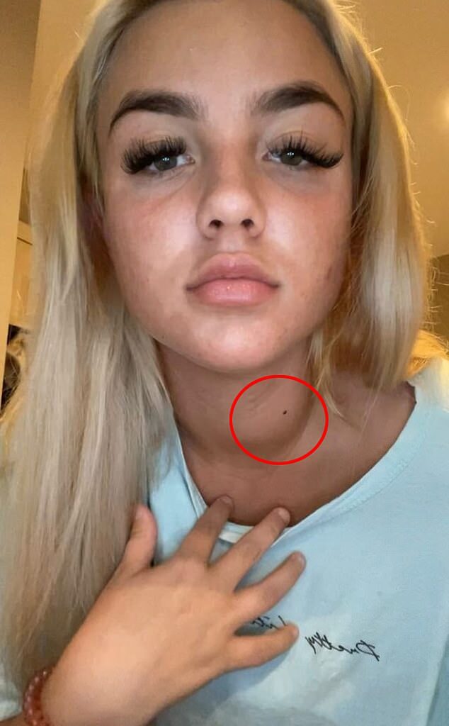 In January 2022, Courtney's friends noticed a lump that was growing on her neck, pushing her to seek another opinion from doctors