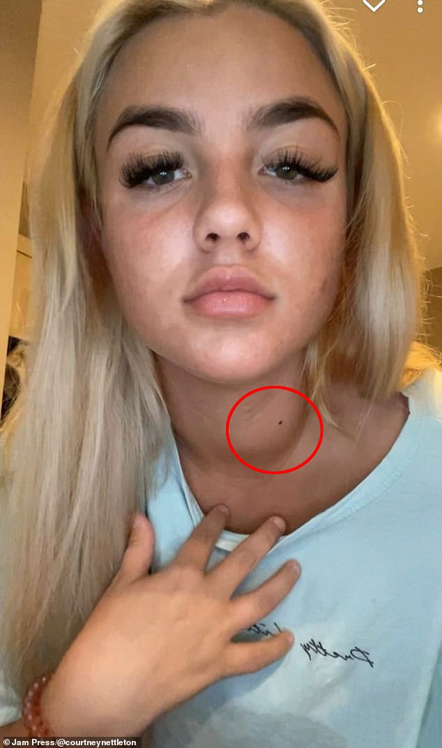 In January 2022, Courtney's friends noticed a lump that was growing on her neck, pushing her to seek another opinion from doctors