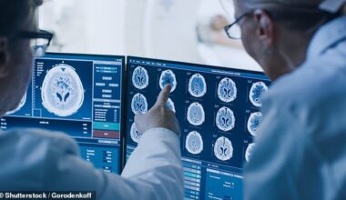 A breakthrough study has revealed there are four roads to the debilitating illness dementia