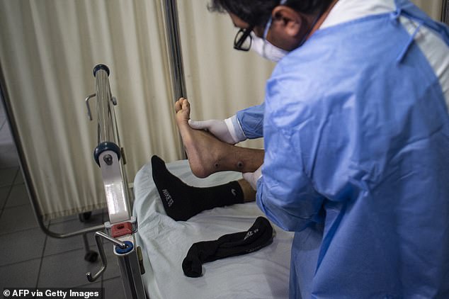 A doctor checks on a patient with sores caused by a monkeypox infection in Lima